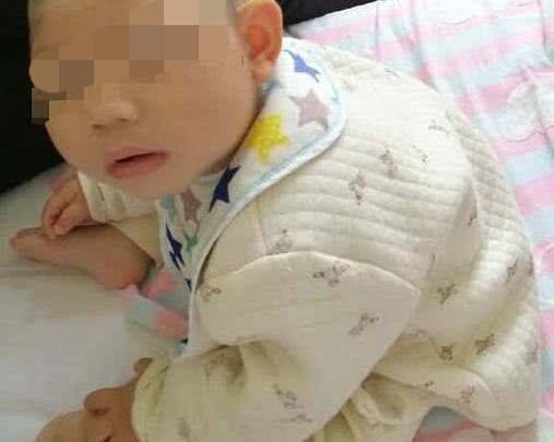 婴儿发育迟缓的表现